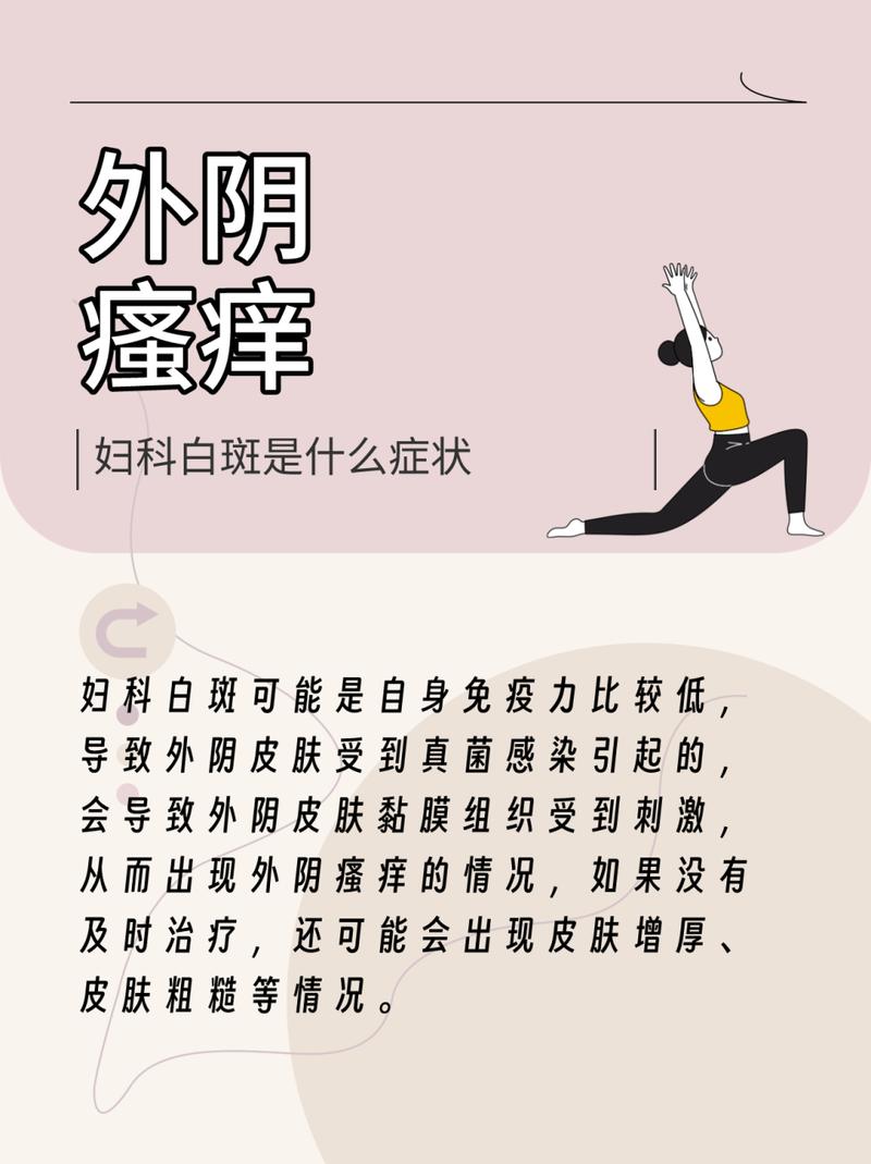 查1把妇科真菌白斑的简单介绍