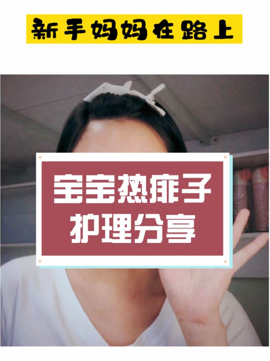 去除婴儿热疹小妙招(小孩热疹最佳治疗方法)