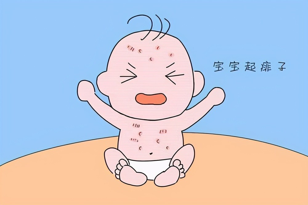 去除婴儿热疹小妙招-婴儿热疹和湿疹图片对比