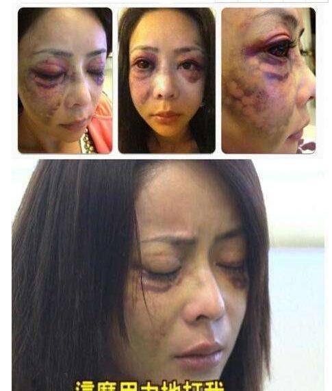 虚拟币爆仓崩溃大哭视频-虚拟币爆仓会亏到负数吗?